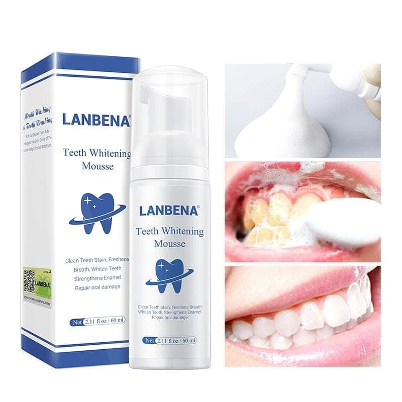 קצף להלבנת שיניים הוא חלופה למשחת שיניים